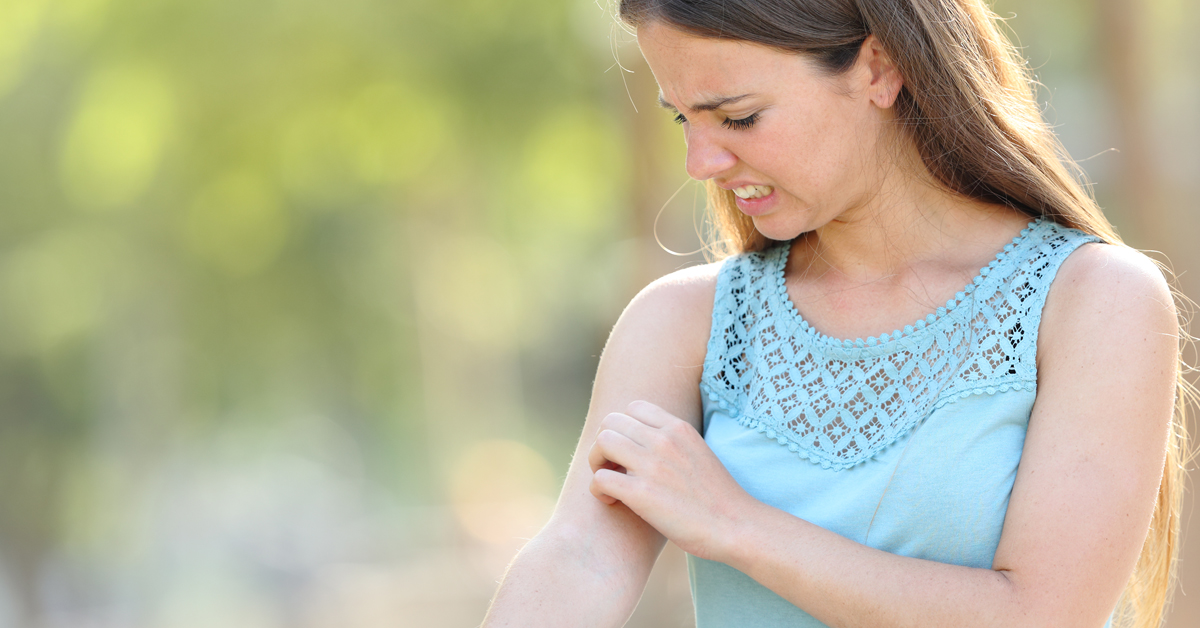 insect bites and stings treatment