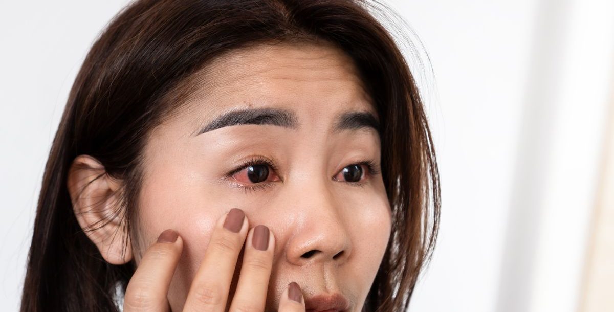 pink eye vs. allergies